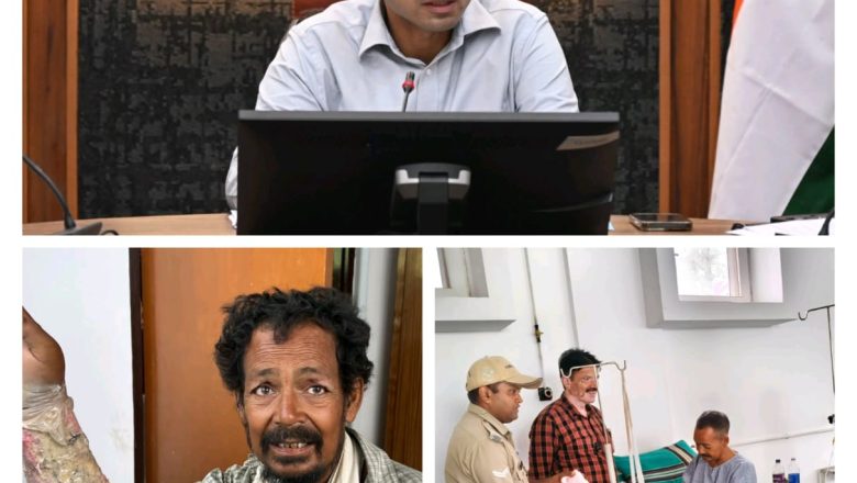 दून अस्पताल से लाइलाज रेफर हुए व्यथित राजू का, बर्न स्पेशलिस्ट हेल्पिंग हैंड्स यहां ऑपरेशन हुआ संपन्न, धन्यवाद डीएम साहब 